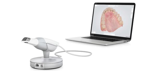Intraoralscanner mit Laptop, auf dem Bildschirm ein digitaler Abdruck des Oberkiefers